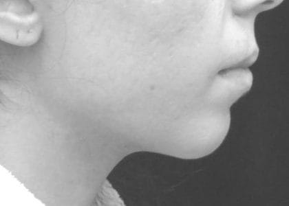 br-8-e1516745623148-420x300